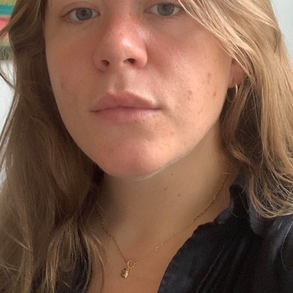 Nanna Meyer Vejborg Larsen